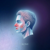 Acne