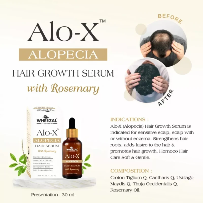 Wheezal Alo X Alopecia Hair Serum (30ml)